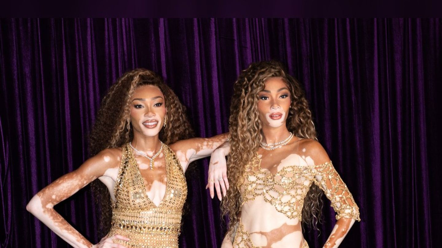 U zlatnoj mini haljini: Winnie Harlow poze sa svojim voskom figurom