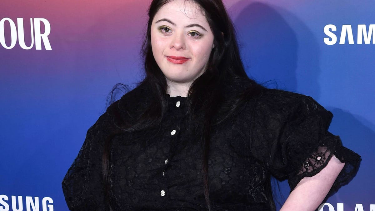 Ellie Goldstein: Model “Vogue” osvajao je plesni podij