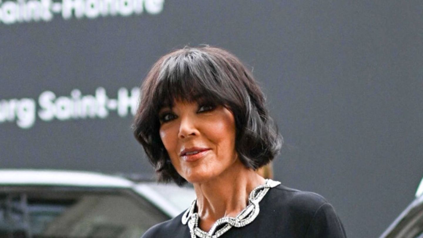 Kris Jenner: Zato joj je pustila da se zategnu